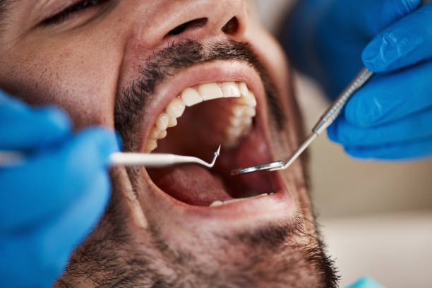 Best Emergency Broken Tooth Repair in Shenandoah, IA